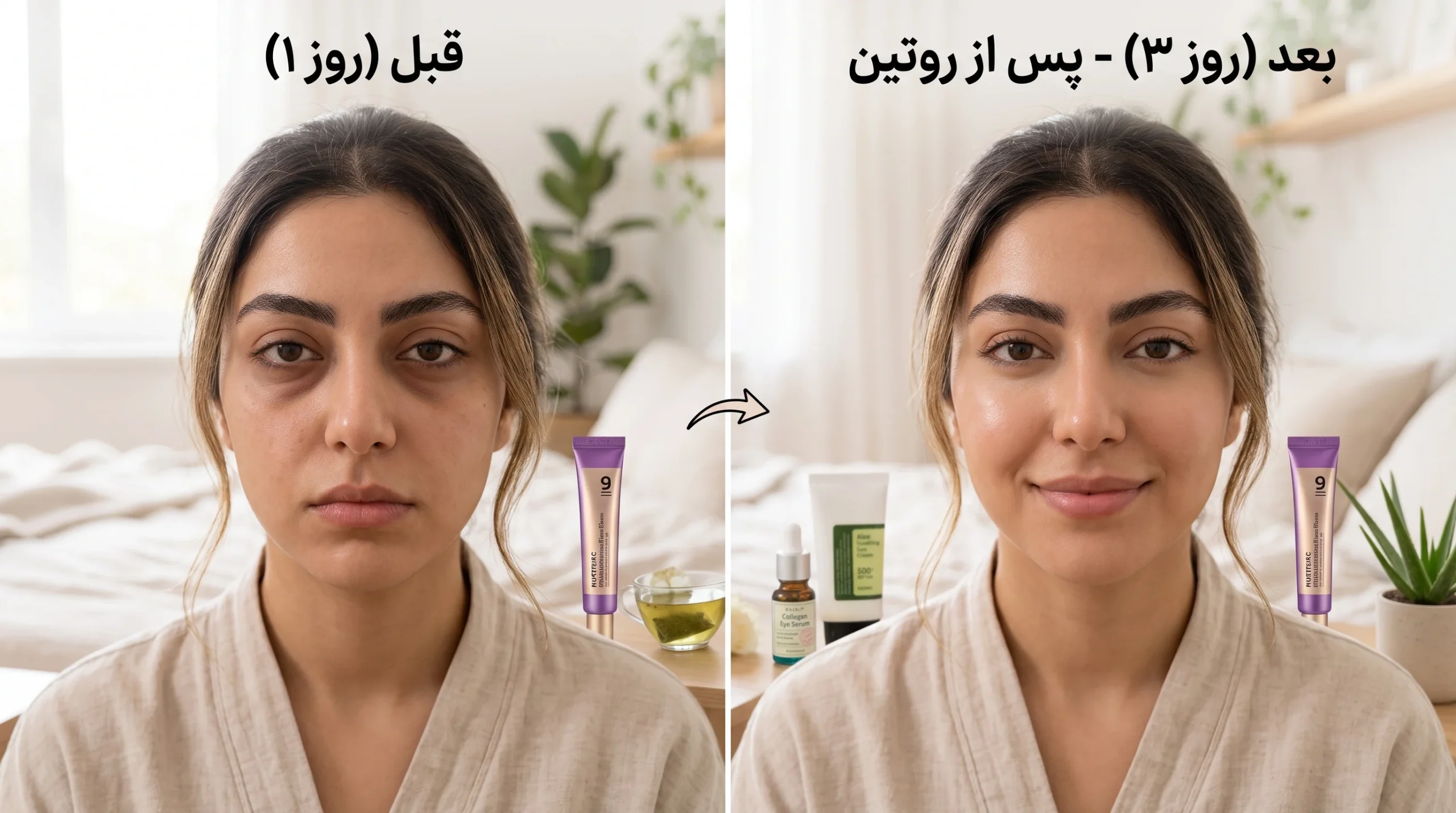 رفع تیرگی دور چشم بعد از روتین 3 روزه